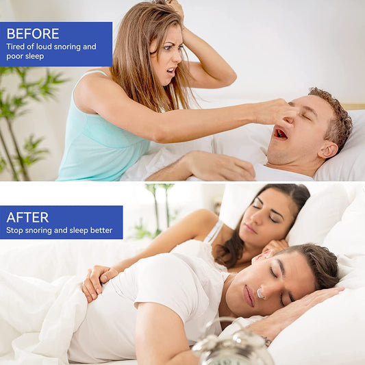 Anti Snoring Nose Clip | Snoring Nose Clips | Digital Electro Shop