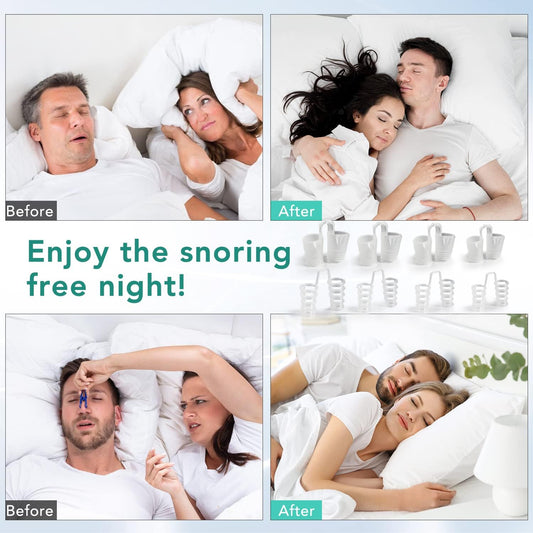 Effective Anti-Snoring Nose Vent Nasal Cones Nasal Dilator to Stop Snoring.  Snore Stopper anti Snoring Devices Easy to Use Snoring Solution